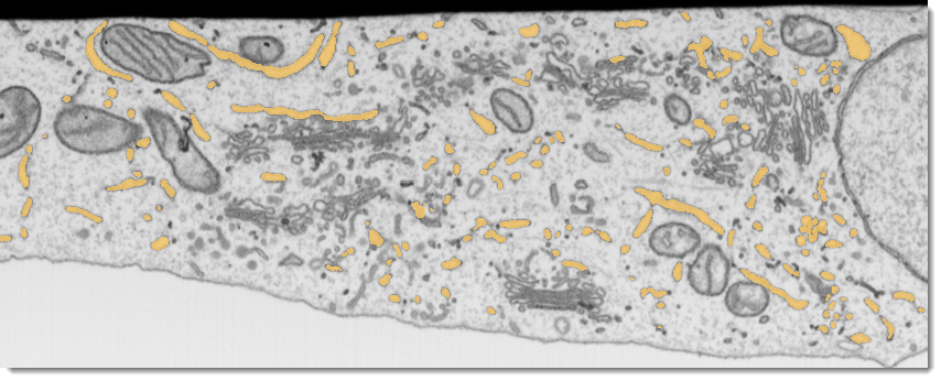 Dataset and model of ER