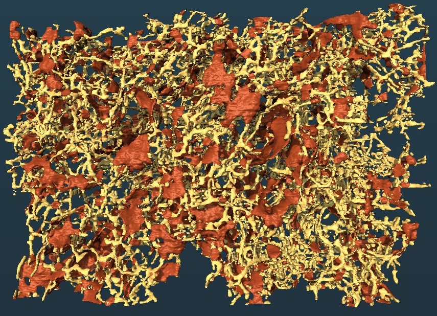 Visualization of sheets (red) and tubules (yellow) compartments of ER