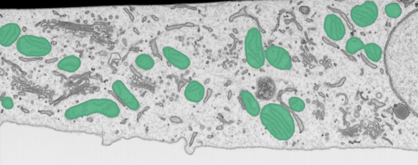 Segmentation of mitochondria