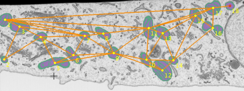 Segmentation of mitochondria