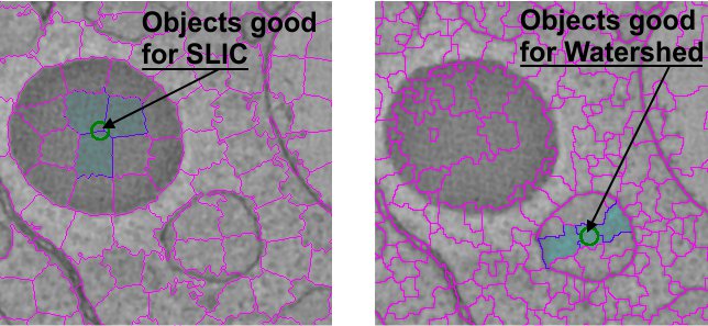 Example of SLIC and Watershed superpixels