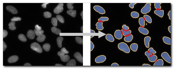 DeepMIB projects → 2D LM Nuclei