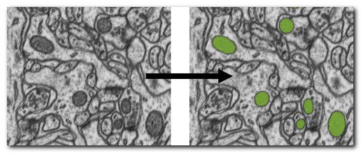 DeepMIB projects → 3D EM Mitochondria