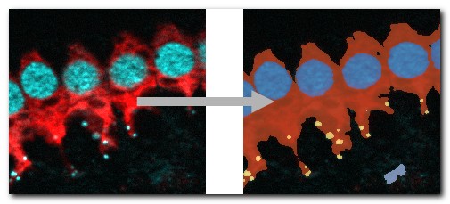 DeepMIB projects → 3D LM Inner Hair Cells