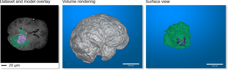 MRI → MATLAB Brain and Model