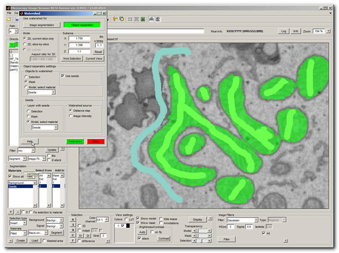 Result of seeded watershed separation