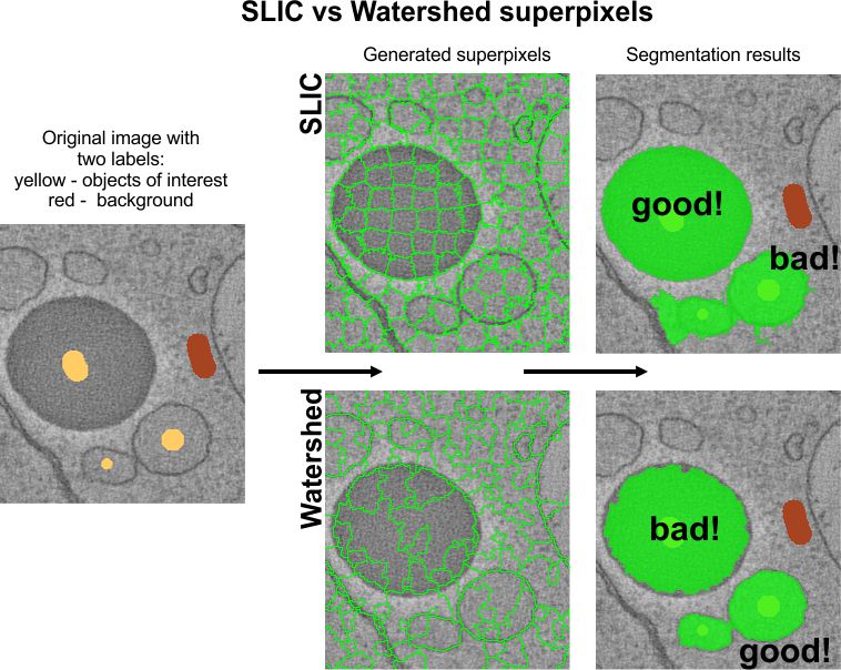 SLIC vs. Watershed superpixels