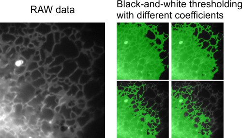 Example dataset of endoplasmic reticulum